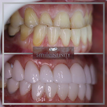 The Smile Infinity Beirut Experience — Official Patient Guide