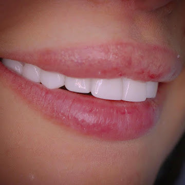 The Smile Infinity Beirut Experience — Official Patient Guide