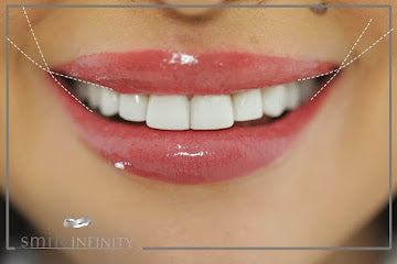 Z-Evolution No-Prep Veneers — All-Inclusive Beirut Experience