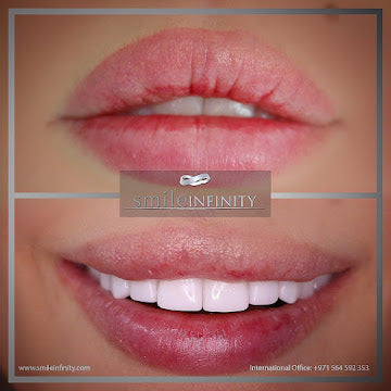 The Smile Infinity Beirut Experience — Official Patient Guide