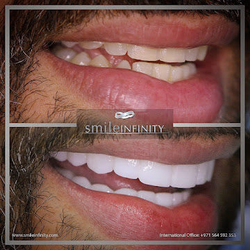 The Smile Infinity Beirut Experience — Official Patient Guide