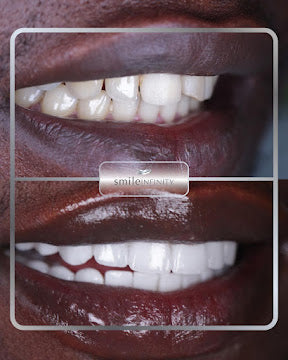 The Smile Infinity Beirut Experience — Official Patient Guide
